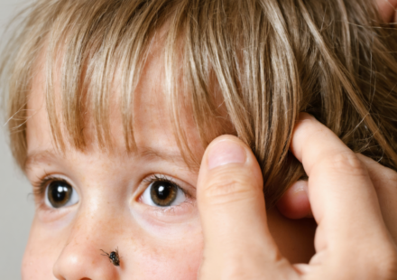 découvrez des conseils pratiques pour détecter rapidement et efficacement la présence de poux chez votre enfant et agir avant qu'ils ne se propagent.