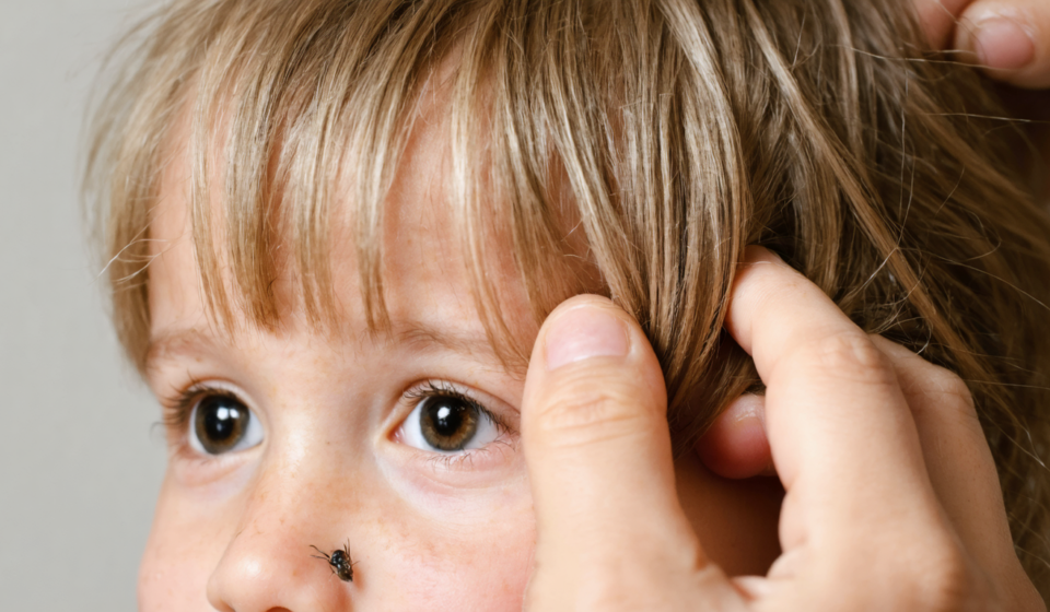 découvrez des conseils pratiques pour détecter rapidement et efficacement la présence de poux chez votre enfant et agir avant qu'ils ne se propagent.